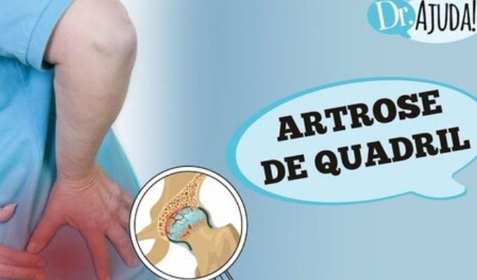  | Jornal Acontece