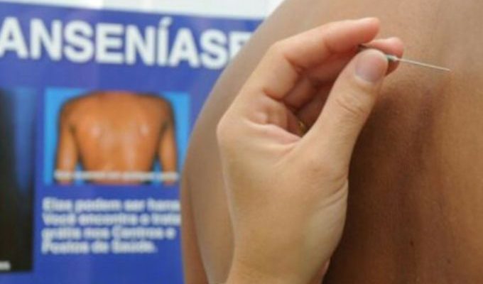 | Jornal Acontece